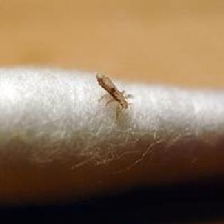 Head Lice - Dealing with Head Lice the Natural Way
